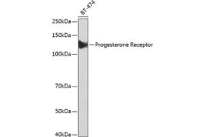 Progesterone Receptor 抗体