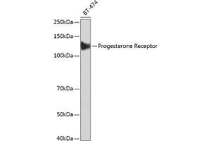 Western blot analysis of extracts of BT-474 cells, using Progesterone Receptor antibody (ABIN7269533) at 1:1000 dilution. (Progesterone Receptor 抗体)