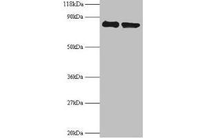 Western blot All lanes: RPS10 antibody at 2 μg/mL Lane 1: EC109 whole cell lysate Lane 2: 293T whole cell lysate Secondary Goat polyclonal to rabbit IgG at 1/15000 dilution Predicted band size: 19 kDa Observed band size: 80 kDa (RPS1 (AA 4-165) 抗体)