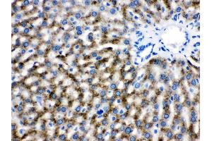 Catalase was detected in paraffin-embedded sections of rat liver tissues using rabbit anti- Catalase Antigen Affinity purified polyclonal antibody (Catalog # ) at 1 µg/mL. (Catalase 抗体  (AA 344-527))