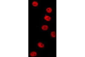 ABIN6277154 staining  HT29 cells by IF/ICC. (IRF3 抗体  (C-Term))