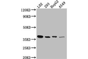 Western Blot Positive WB detected in: L02 whole cell lysate, HEK293 whole cell lysate, HepG2 whole cell lysate, A549 whole cell lysate All lanes: LRG1 antibody at 1:1000 Secondary Goat polyclonal to rabbit IgG at 1/50000 dilution Predicted band size: 39 kDa Observed band size: 39 kDa (Recombinant LRG1 抗体)