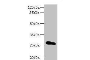 Western blot All lanes: CLDN18 antibody IgG at 3. (Claudin 18 抗体  (AA 20-80))