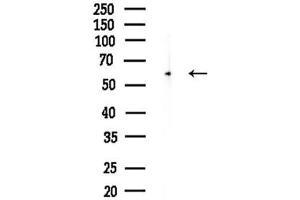 Western blot analysis of lysates from Mouse brain, using PSAP Antibody at 1/1000 dilution.