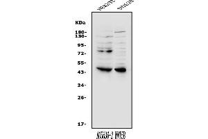 Western blot analysis of Wnt5b using anti-Wnt5b antibody (ABIN7600323).