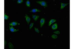 Immunofluorescence (IF) image for anti-ATPase, H+ Transporting, Lysosomal 70kDa, V1 Subunit A (ATP6V1A) (AA 159-405), (Catalytic Subunit A) antibody (ABIN7175225)