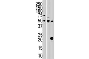 The STYK1 polyclonal antibody  is used in Western blot to detect STYK1 in 293 (left) , CEM (center) , and mouse kidney (right) cell line and tissue lysates. (STYK1 抗体  (N-Term))