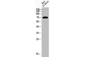 Western Blot analysis of RAT-kidney cells using Acetyl-HSP70 (K246) Polyclonal Antibody (HSP70 1A 抗体  (acLys246))