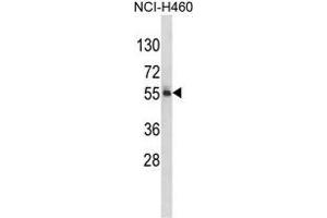 Western blot analysis of FTO Antibody (N-term) in NCI-H460 cell line lysates (35 µg/lane).