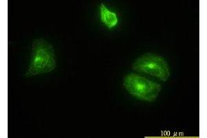 Image no. 4 for anti-Clathrin, Light Chain B (CLTB) (AA 1-212) antibody (ABIN598618) (CLTB 抗体  (AA 1-212))