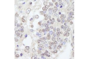 Immunohistochemistry (IHC) image for anti-Tripartite Motif Containing 33 (TRIM33) (C-Term) antibody (ABIN7448843) (TRIM33 抗体  (C-Term))