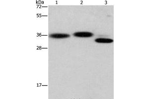 Western Blot analysis of Hela cell, Mouse brain and heart tissue using CAPZA2 Polyclonal Antibody at dilution of 1:650 (CAPZA2 抗体)