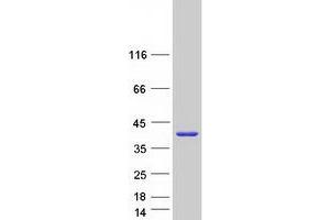 Western Blotting (WB) image for Sulfotransferase Family, Cytosolic, 1A, Phenol-Preferring, Member 4 (SULT1A4) (Transcript Variant 1) protein (Myc-DYKDDDDK Tag) (ABIN2732935)