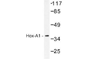 Image no. 1 for anti-Homeobox A1 (HOXA1) antibody (ABIN272197) (HOXA1 抗体)