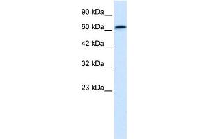 WB Suggested Anti-PSIP1 Antibody Titration:  0.