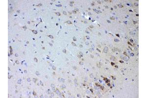 IHC analysis of IL15RA using anti-IL15RA antibody . (IL15RA 抗体  (AA 31-174))