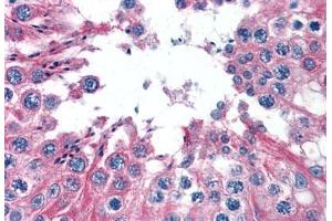 Human Testis: Formalin-Fixed, Paraffin-Embedded (FFPE) (TUBA3C 抗体  (AA 1-419))