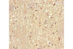 Immunohistochemistry of paraffin-embedded human brain tissue using ABIN7174494 at dilution of 1:100 (UBE2V2 抗体  (AA 2-145))