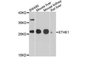 Western blot analysis of extracts of various cell lines, using ETHE1 antibody. (ETHE1 抗体  (AA 8-245))