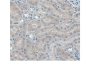 IHC-P analysis of Mouse Kidney Tissue, with DAB staining. (CCL2 抗体  (AA 24-96))