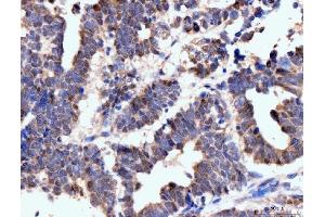 IHC analysis of Neurofibromin/NF1 using anti-Neurofibromin/NF1 antibody (ABIN7600196). (Neurofibromin 1 抗体  (AA 160-270))