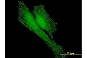 Immunofluorescence of monoclonal antibody to BARD1 on HeLa cell. (BARD1 抗体  (AA 658-757))