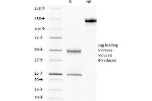 SDS-PAGE Analysis Purified HCG-beta Mouse Monoclonal Antibody (HCGb/211). (CGB 抗体)