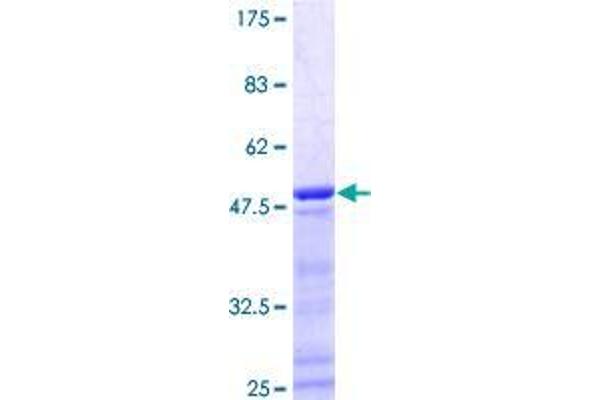 G Substrate Protein (Gsbs) (GST tag)