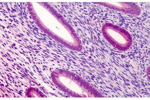 Human Uterus: Formalin-Fixed, Paraffin-Embedded (FFPE) (ATG16L1 抗体  (Internal Region))