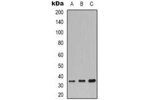 Western blot analysis of CDC34 expression in K562 (A), PC3 (B), mouse brain (C) whole cell lysates.