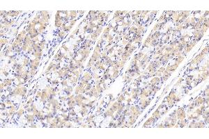 Detection of TNS1 in Human Stomach Tissue using Polyclonal Antibody to Tensin 1 (TNS1) (Tensin 1 抗体  (AA 4-307))