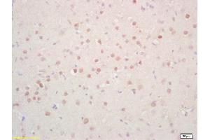 Formalin-fixed and paraffin embedded rat brain labeled with Rabbit Anti Phosphoserine/threonine/tyrosine Polyclonal Antibody, Unconjugated (ABIN1385069) at 1:200 followed by conjugation to the secondary antibody and DAB staining (Phosphoserine/Phosphothreonine/Phosphotyrosine (phosphorylated) 抗体)