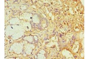 Immunohistochemistry of paraffin-embedded human gallbladder tissue using ABIN7144783 at dilution of 1:100 (Ataxin 1 抗体  (AA 586-815))
