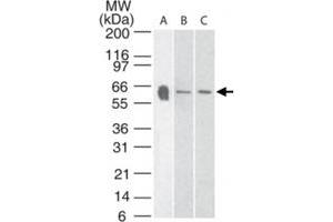 Western blot analysis of Htr3a in A) human, B) mouse and C) rat brain tissue lysate using Htr3a polyclonal antibody  at 3 ug/mL . (Serotonin Receptor 3A 抗体  (AA 21-36))
