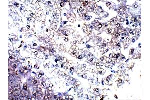 Detecting C4a in Baboon Kidney using ABIN2749472 (C4A 抗体  (AA 1220-1270))