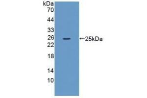 Detection of Recombinant XCR1, Mouse using Polyclonal Antibody to Chemokine C-Motif Receptor 1 (XCR1) (XCR1 抗体  (AA 244-322))
