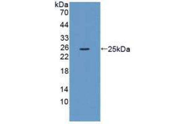 XCR1 Antikörper  (AA 244-322)
