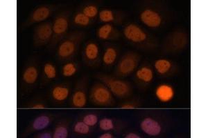 Immunofluorescence analysis of HeLa cells using KLF6 Polyclonal Antibody at dilution of 1:100. (KLF6 抗体)