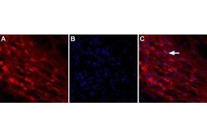Expression of NLGN2 in rat brain - Immunnohistochemical staining of rat reticular thalamic nucleus using Anti-Neuroligin 2 (extracellular) Antibody (ABIN7043362, ABIN7044682 and ABIN7044683). (Neuroligin 2 抗体  (Extracellular, N-Term))