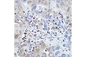 Immunohistochemistry (IHC) image for anti-Fanconi Anemia, Complementation Group C (FANCC) (AA 319-558) antibody (ABIN3022594)