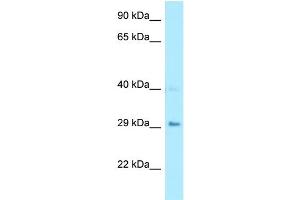 WB Suggested Anti-CA7 Antibody Titration: 1. (CA7 抗体  (Middle Region))
