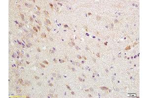 Formalin-fixed and paraffin embedded rat brain tissue labeled with Anti-ChRM1/Acetylcholine receptor(M1) Polyclonal Antibody, Unconjugated  at 1:200 followed by conjugation to the secondary antibody, (SP-0023), and DAB staining (CHRM1 抗体  (AA 321-420))