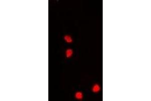Immunofluorescent analysis of Nucleostemin staining in A549 cells. (Nucleostemin 抗体)