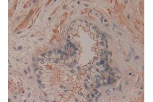 Detection of CD200 in Human Prostate Tissue using Polyclonal Antibody to Cluster Of Differentiation 200 (CD200) (CD200 抗体  (AA 31-232))
