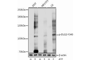 Western blot analysis of extracts of various cell lines, using Phospho-PSD93/chapsyn-110/DLG2-Y340 antibody (ABIN7266792) at 1:1000 dilution. (DLG2 抗体  (pTyr340))