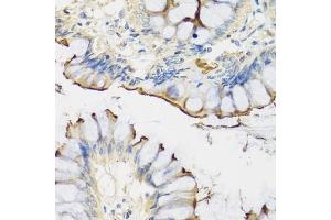 Immunohistochemistry of paraffin-embedded human colon using CRTAP antibody (ABIN1679366, ABIN3018913, ABIN3018914 and ABIN6220627) at dilution of 1:100 (40x lens). (CRTAP 抗体  (AA 20-240))