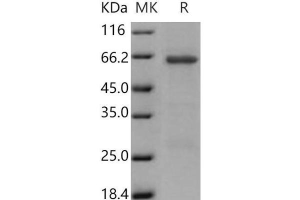 TRIB3 Protein (GST tag)