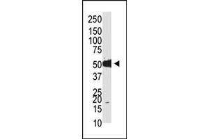 Image no. 1 for anti-tRNA Aspartic Acid Methyltransferase 1 (TRDMT1) (N-Term) antibody (ABIN356589) (Dnmt2 抗体  (N-Term))