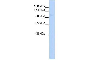 WB Suggested Anti-ZBTB11 Antibody Titration:  0. (ZBTB11 抗体  (N-Term))
