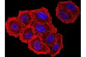 Immunocytochemistry (ICC) image for anti-ZFP91 Zinc Finger Protein (ZFP91) (AA 162-304) antibody (ABIN5542699)